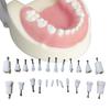 24Pcs Kids Dental Teeth Practice Model Pediatric Teaching Aids For Children Teeth Training Deciduous Tooth Model