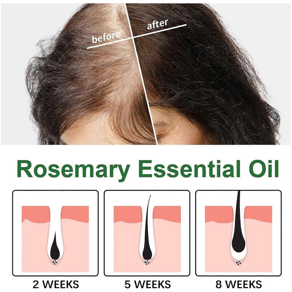 3PC Rosemary Essential Oil Refreshing Nourishing Soft Hair Thick Hair Care Scalp