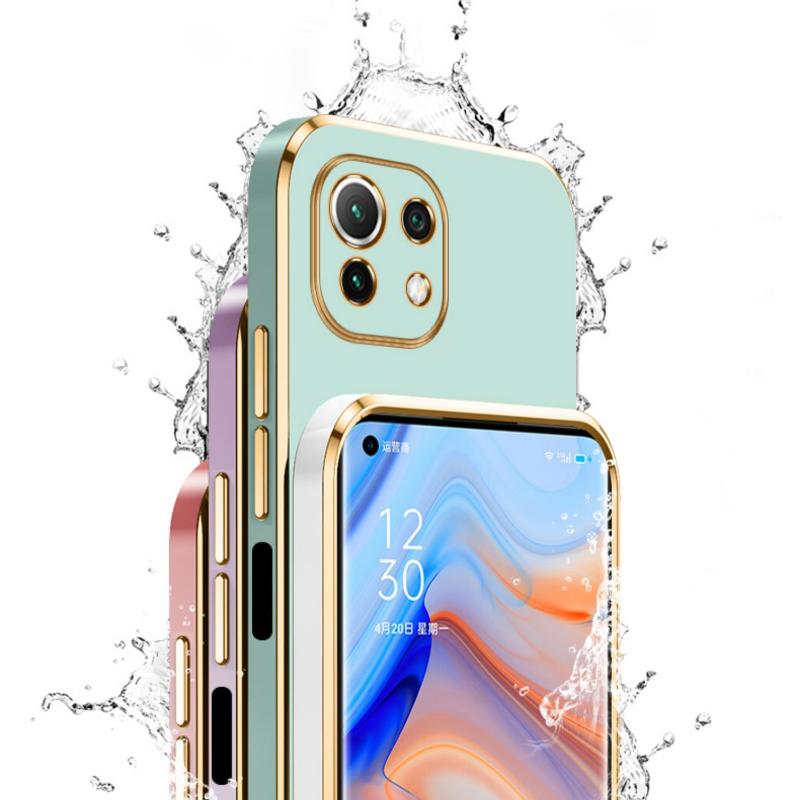 400Pro Case for Honor 400 Pro Glossy Full Plating Lanyard Soft Phone Case for Honor 400 Lite Lens Protection Silicone Cover