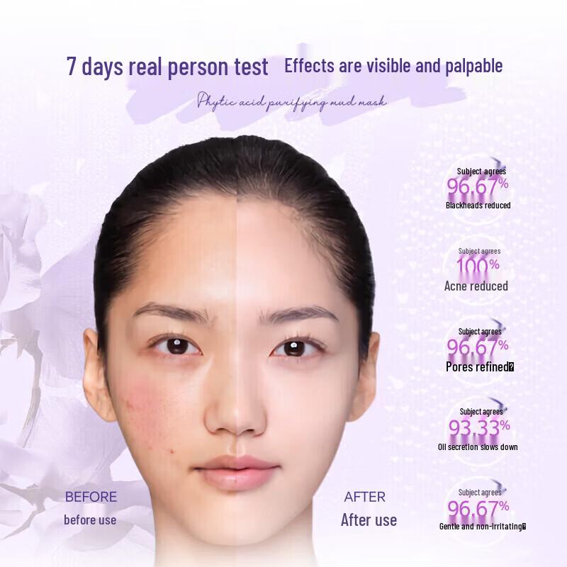 ELL Perilla Azelaic Acid Cleansing Mud Mask