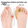 Anti-slip Toe Separator 1 Pair for Overlapping Toes, Soft SEBS Bunion Corrector, Double Double-hole Spacer Hole Foot Hallux Valgus, Breathable