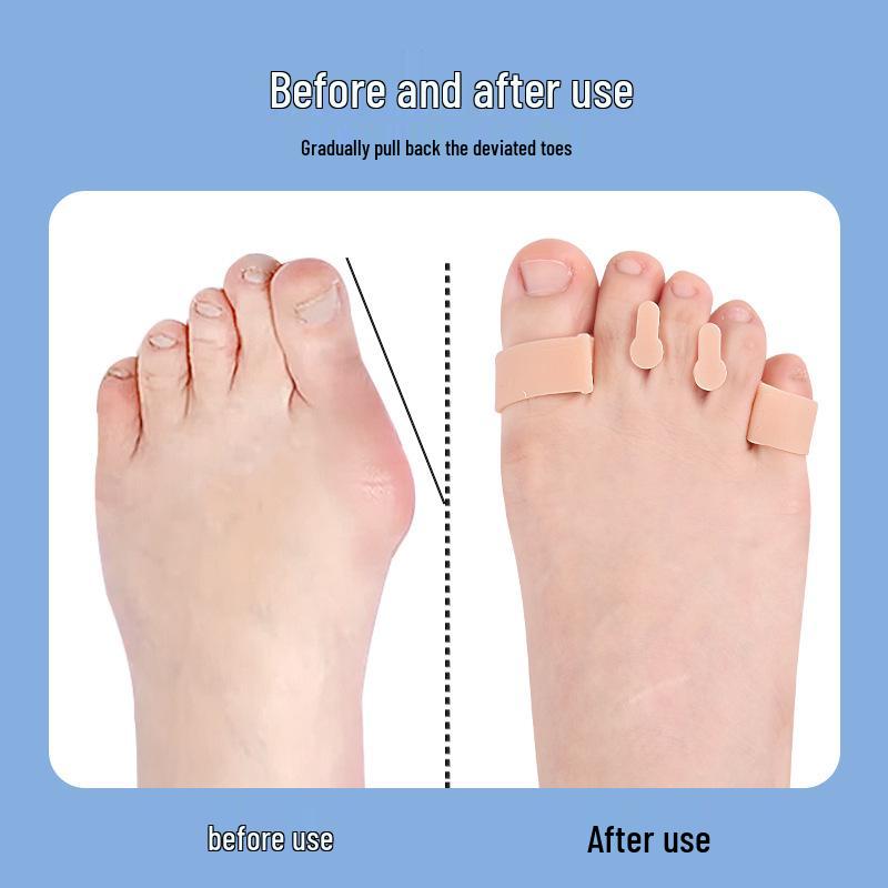 Double-Hole Snail Toe Separator: Soft Bunion & Overlapping Toe Corrector for Men & Women