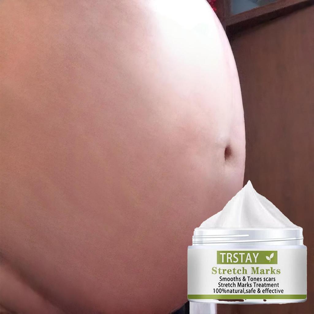 Těhotné ženy opravují rýhy na břiše, tělový krém proti vyblednutí, hydratují produkty péče o pleť, odstraňují těhotenské vrásky, tukové rýhy, krém na obličej