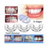 3 peças Conjunto de Treinador de Dentes Ortodôntico para Adultos Alinhamento de Retentores de Dentes Ortopédicos 3 Fases Alisador de Dentes Z2g