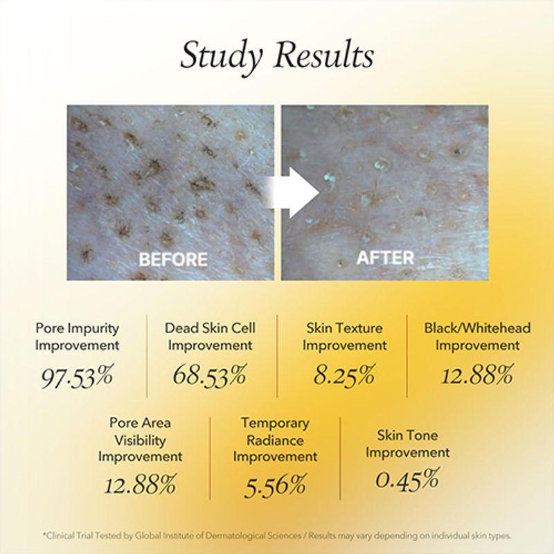 Aprilskin Real Calendula Peel Off Pack 100ml