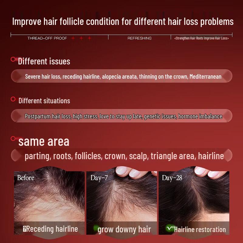 Vetes Anti-Hair Loss & Growth Scalp Essence