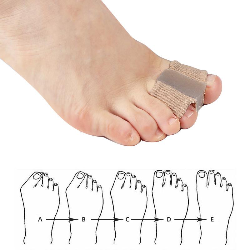 Fiber Toe Separators for Hallux Valgus & Bunion Relief, Men & Women, Double Hole Sleeves