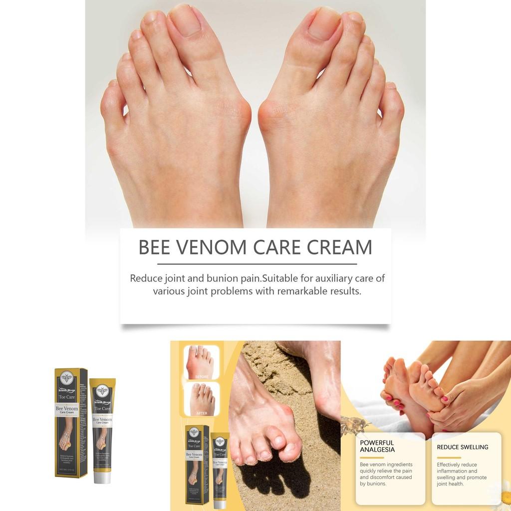 South Moon Bee Venom Care Cream For Correcting Swollen Feet And Joint Discomfort