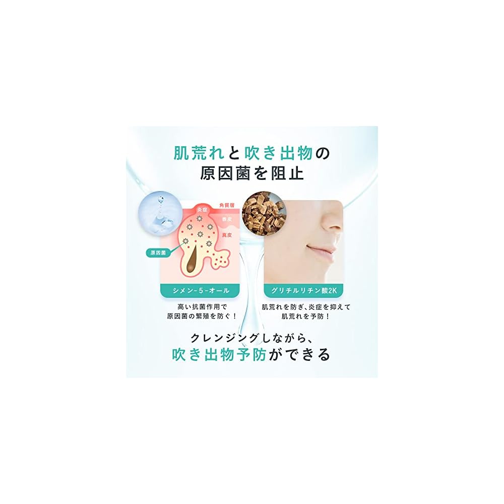 Sensitive Skin's Best Friend: Medicated Acne Care Cleansing Gel 130g