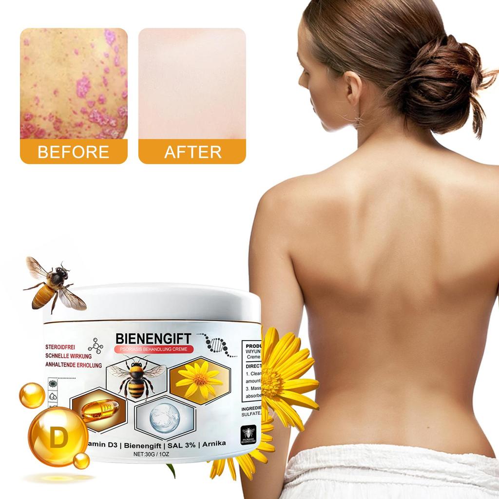 30g Bee Venom Body Cream Body Skin Nourishing Moisturizing Discomfort Relieving Care Daily Massage Applicator Cream
