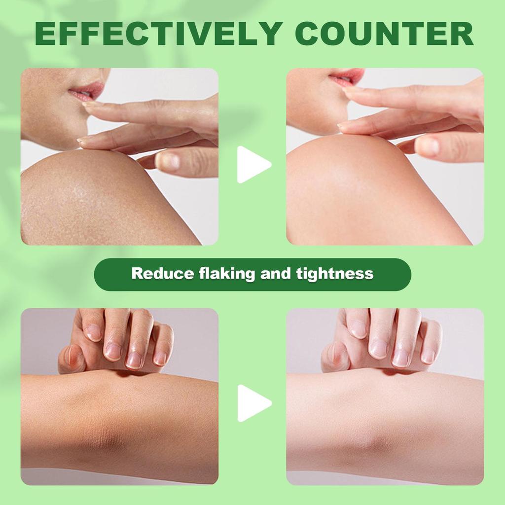 %60 Üre Kremi+%2 Salisilik Asit, Pürüzlü Ayaklar ve Eller İçin, Aloe Vera İçerikli, Peeling Etkili ve Nemlendirici, Yağlı Değil, Yumuşatır ve Pürüzsüzleştirir-200G