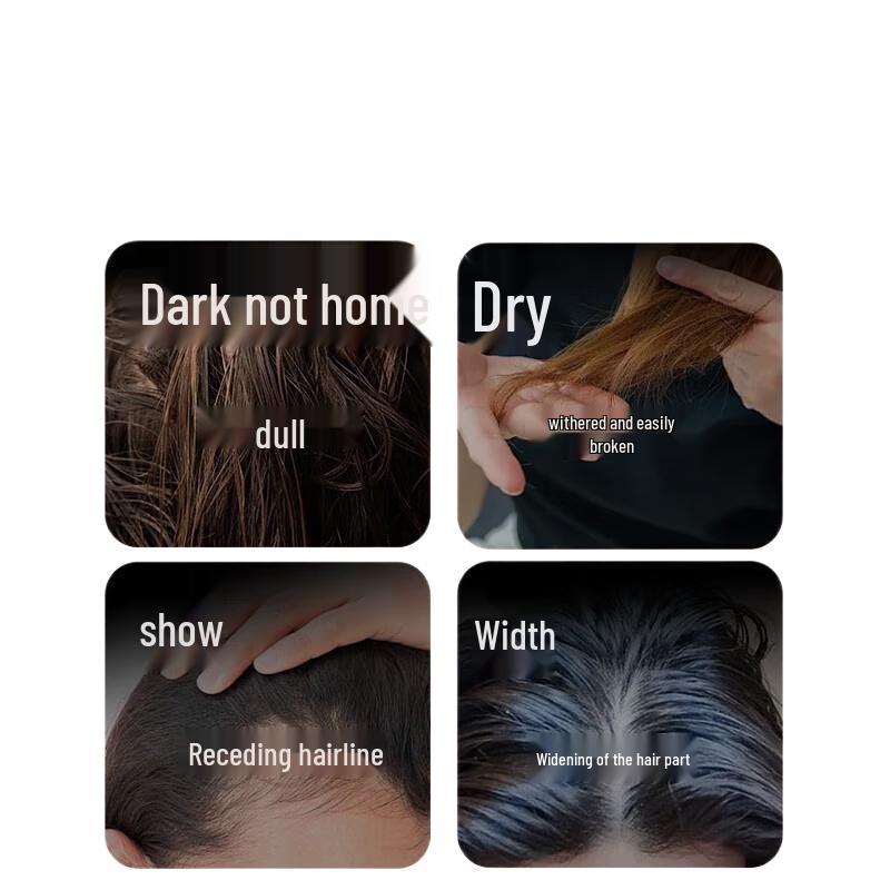 

Bawang He Shou Wu Anti-Hair Loss & Growth Shampoo