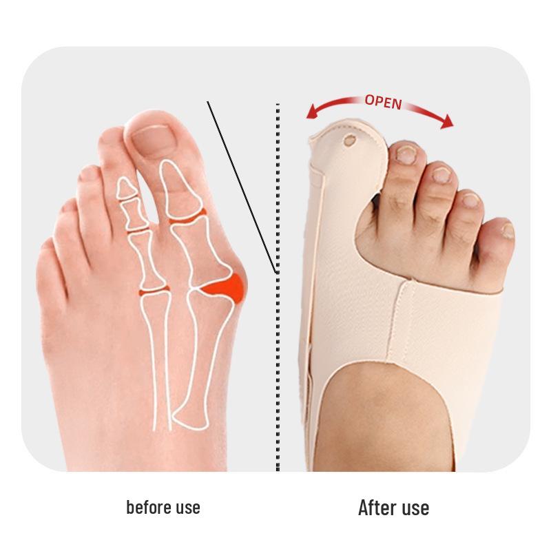 Verstellbarer Ballenzeh-Korrektor Zehenmanschette für Tag- und Nachtgebrauch