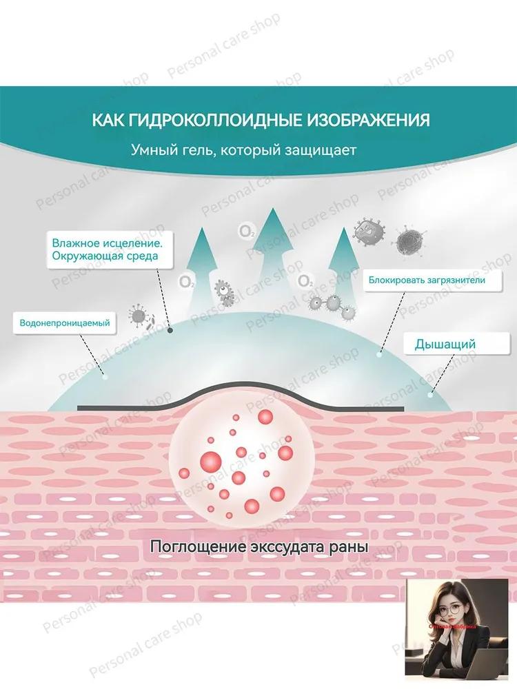 Wound dressing bandage for skin wounds, burns, bedsore, trophic ulcer, free cut hydrocoll type hydrocolloid for moderate to heavily exuding wounds