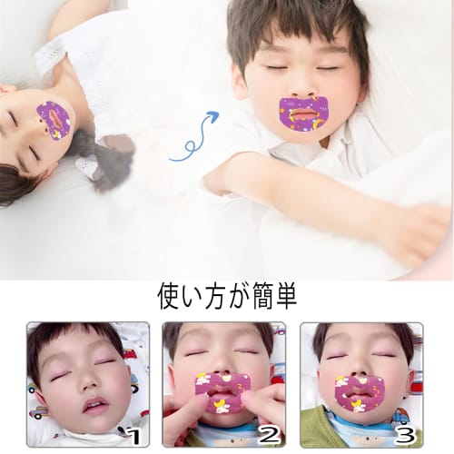 Mouth-Closing Tape, Prevents Mouth Breathing, Nasal Breathing Tape, Prevents Adenoid Face, Prevents Dry Throat, Promotes Nasal Breathing, Improves Sle