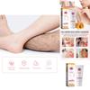 Eelhoe Gentle Hair Removal Cream For Smooth And Soft Skin Ideal For Face And Body