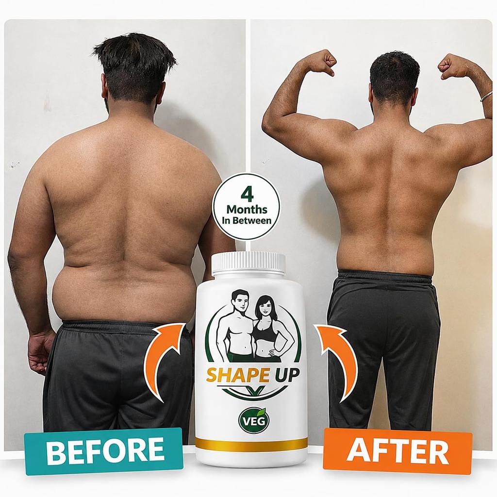 Shape Up Gewichtsverlies Capsules | Natuurlijk Vetverbrandend Supplement met Acetyl L-Carnitine Voor Mannen & Vrouwen | FSSAI Gecertificeerd | Ondersteunt Metabolisme & R