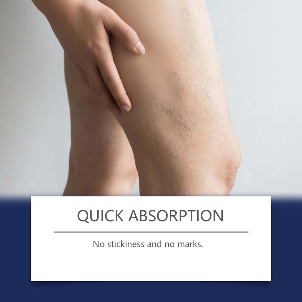 Leg Care Spray To Discomfort, Soreness, Numbness And Swelling Caused By Dilated Blood Vessels. External Care Spray For Leg Massage,30ML