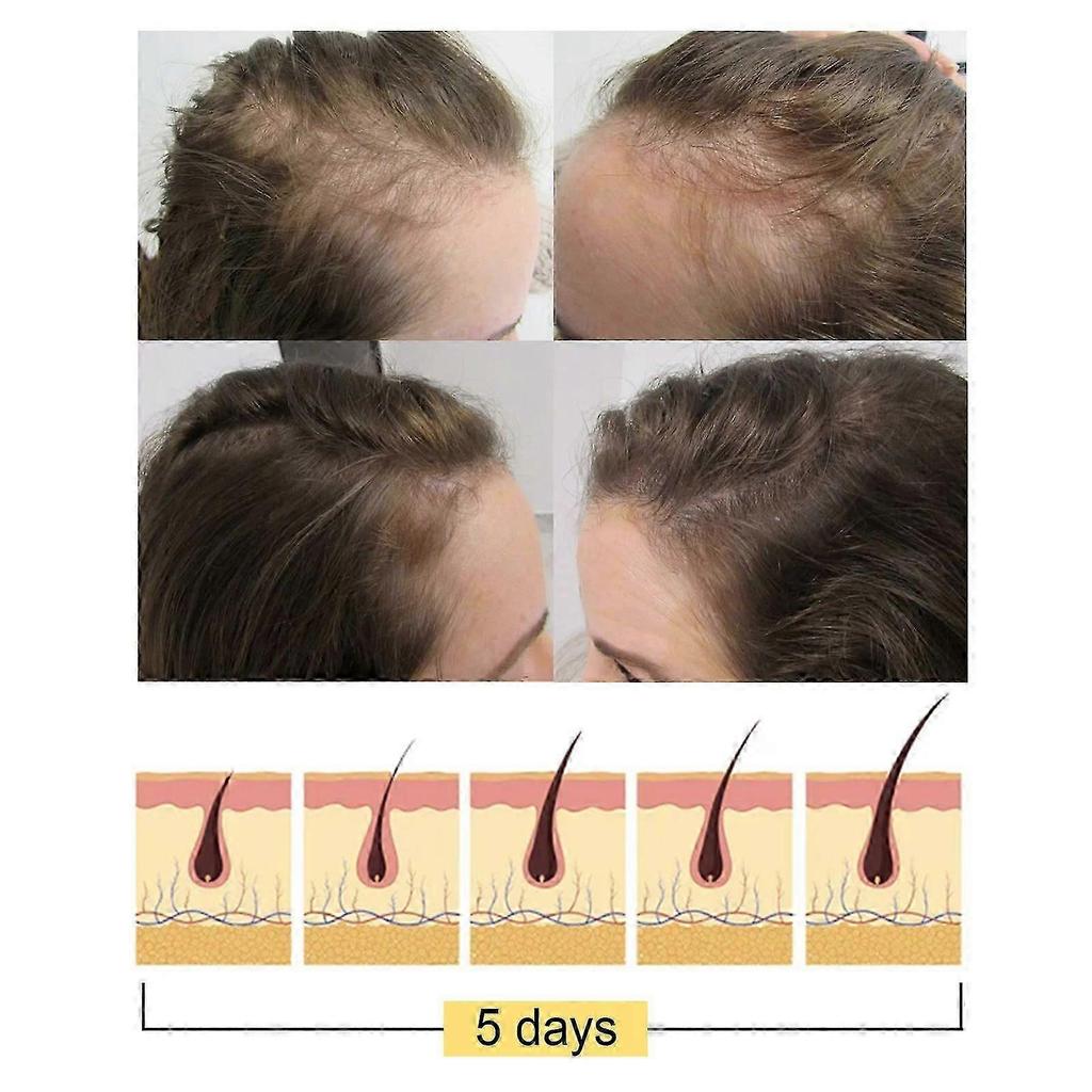 Nourishing Hair Care Soap for Hair Growth & Scalp Relief - Gentle, Natural Cleanser with Glycerin & Sodium Palmitate, Promotes Thicker, Resilient Hair