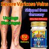 Effective Varicose Veins Care – Soothes and Strengthens, EU 3-Day Delivery