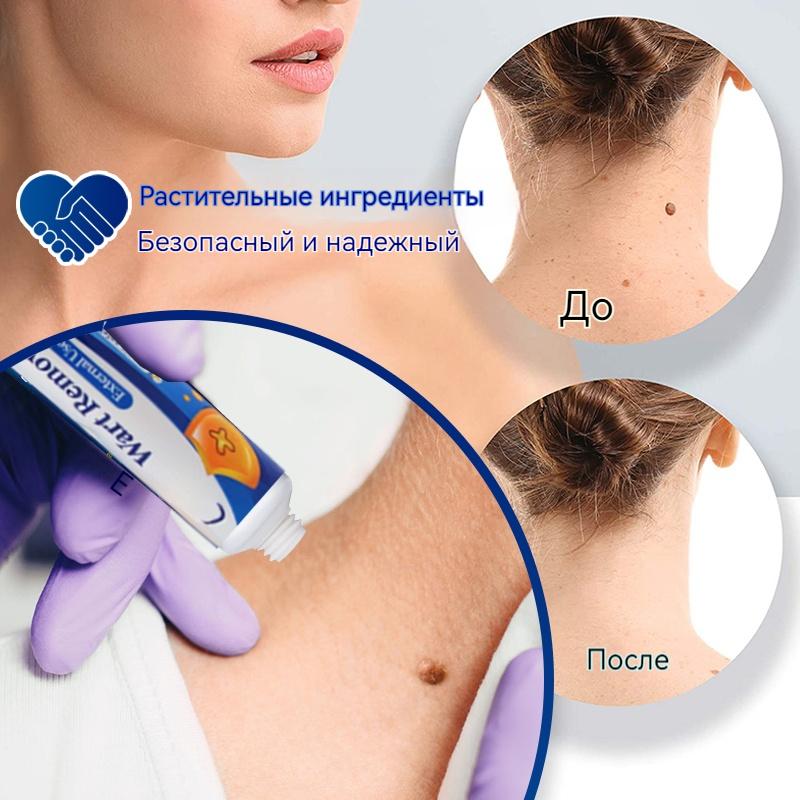 ZB Mole Removal Ointment Skin Care Mild Ingredients Collagen Daily Skin Care