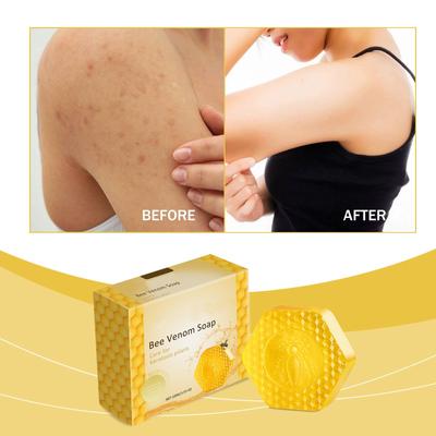Derma Care Sabunu Arı Zehiri Sabunu Nemlendirici ve Temizleyici Birikmiş Sabunu Temizlemeye Yardımcı Olur Her Yaştan Erkek ve Kadın