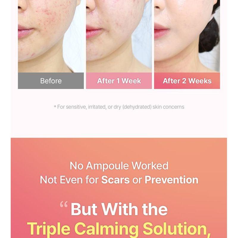 mommy care - Lotus Flower Leaf Calming Ampoule