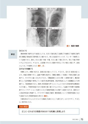 Diagnostic Imaging Dojo Updated Edition <Chest Edition>