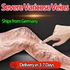 Special Shu Ointment for Varicose Veins To Treat Blood Vessel Blockage and Dredge In the Legs