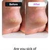 baren - Shea Butter Sleeping Heel Patch 10 pcs