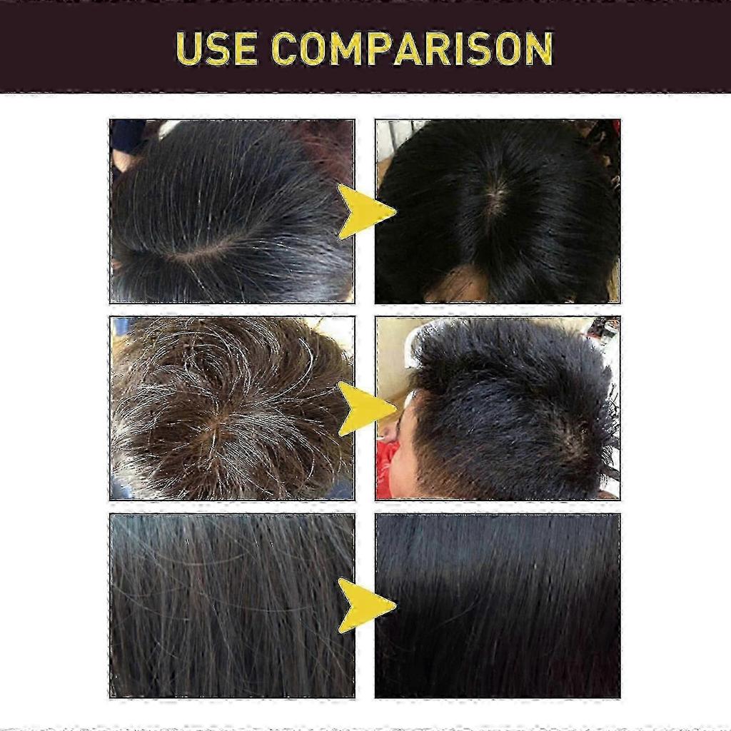 Shampoo,hair Dye Shampoo 3 In1 For Gray Hair, Herbal Black Hair Dye Shampoo For Men Grey Coverage (black) - Hz