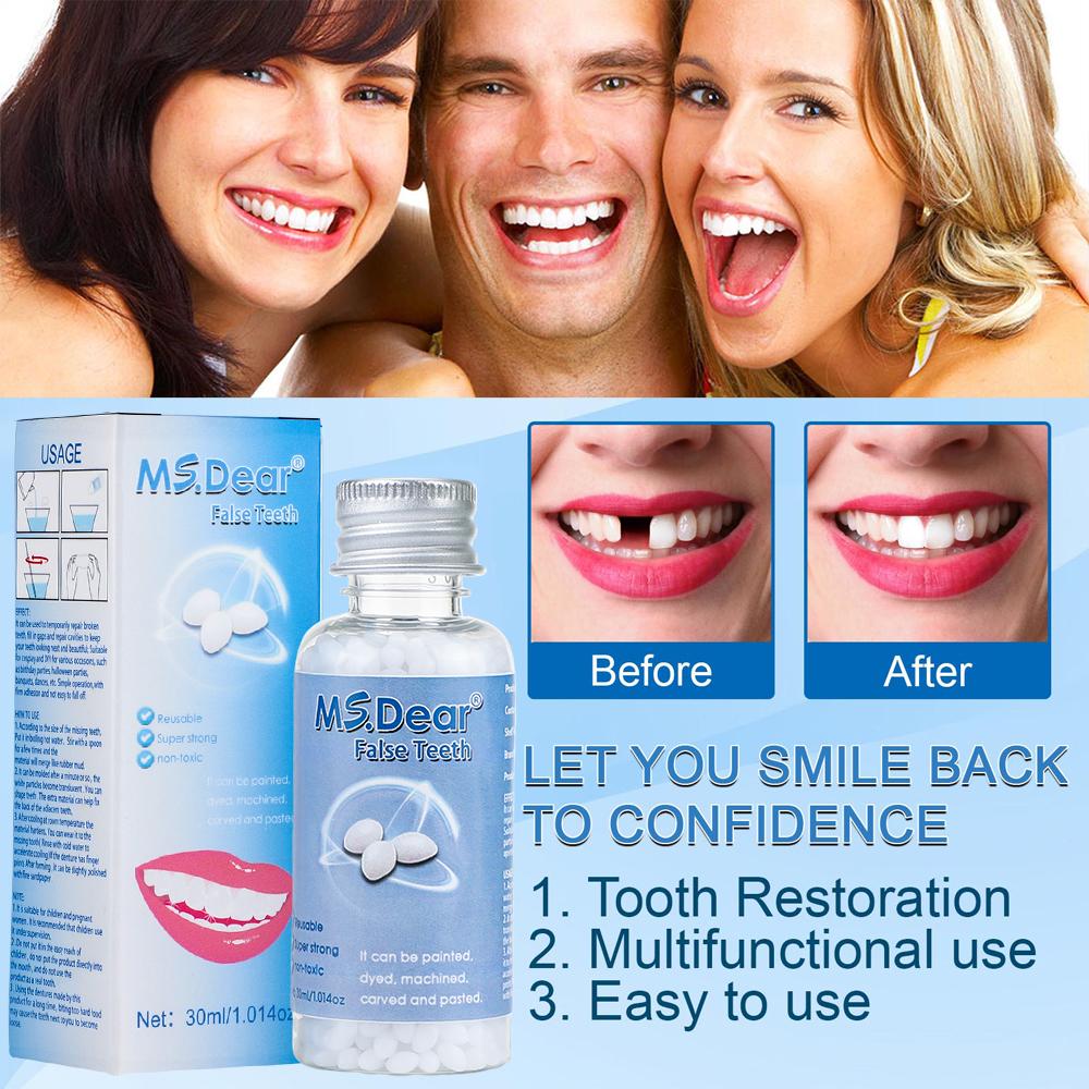 30ml Resin Temporary Tooth Repair Granules Teeth Gaps Missing Broken Tooth Filling Moldable Dentures Adhesive False Teeth Tools