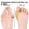 Sensitive Skin Toe Spacer 1 Pair Separator for Overlapping Toes, Soft SEBS Bunion Corrector, Double Silicone Hole Foot Hallux Valgus, Breathable