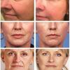Whitening Freckle Cream Effektiv Fjern Melasma Dark Spots Cream Fade Fuktighet Gjøre Glatt Skjønnhet Ansikt Hudpleie