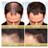 Grau Weiß Haarbehandlungsserum Weiß zu Schwarz Reparatur Natürliche Farbe Schwarzer Reis Nährspray Anti Haarausfall Hochwertiges Produkt