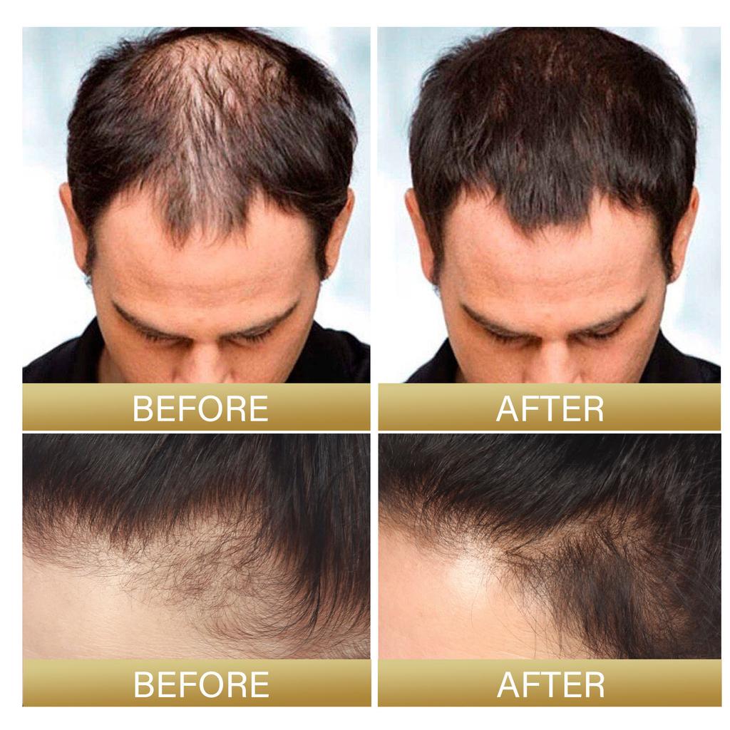Grau Weiß Haarbehandlungsserum Weiß zu Schwarz Reparatur Natürliche Farbe Schwarzer Reis Nährspray Anti Haarausfall Hochwertiges Produkt
