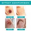 Wound Relief Gel, Liquid Wound Suture Glue, Isolate And Keep Dry 10ml