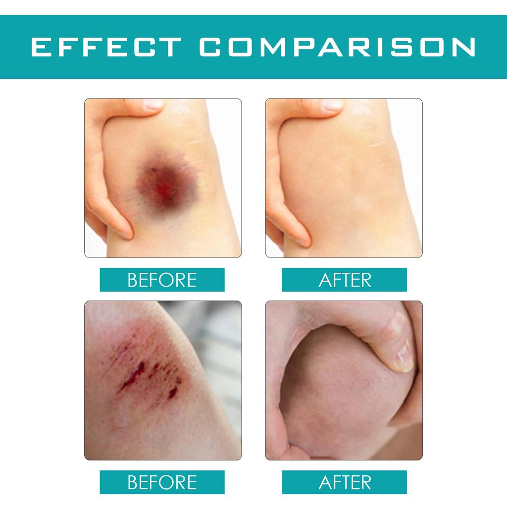 Wound Relief Gel, Liquid Wound Suture Glue, Isolate And Keep Dry 10ml