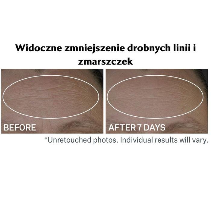 Strivectin Serum Wypełniające Zmarszczki I Linie Peptide Plump™