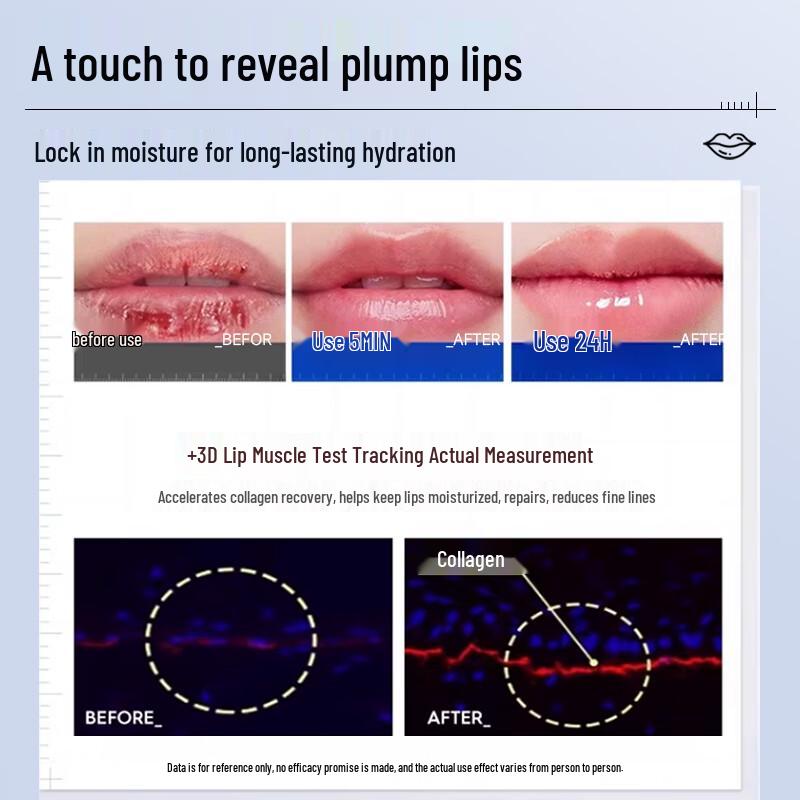 Feuchtigkeitsspendender Lippenbalsam für trockene, rissige Lippen & Cheilitis
