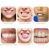 Whitening Temporary Fake Tooth DIY Cosmetic Dental Veneer Oral Care Veneer Dentures  Teeth Makeup