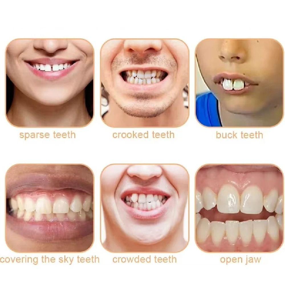 Whitening Temporary Fake Tooth DIY Cosmetic Dental Veneer Oral Care Veneer Dentures Teeth Makeup