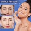Durable And Safe 2 Rolls Facial Myofascial Lift Tape Face Lift Tape Face Toning Belts Anti Wrinkle Patches Anti Freeze Stickers Neck Lift Tape