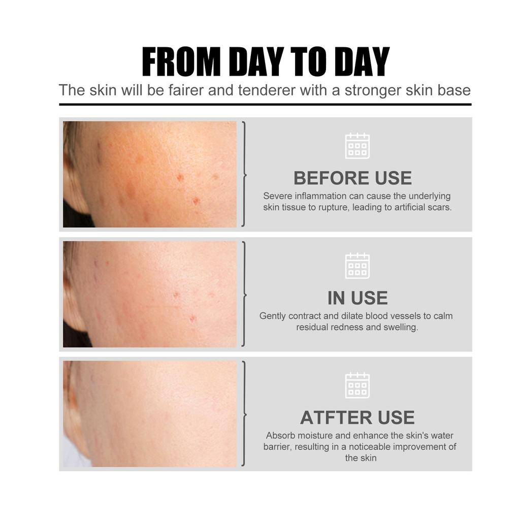 EELHOE Niacinamide Face Serum Whitening Anti Wrinkles Removal Spots Freckle Face Care Sodium Hyaluronate Facial Essence 50ml