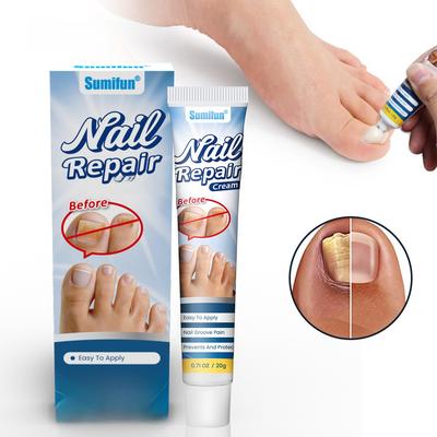 Sumifun Tırnak Mantarı Tedavi Kremi, Onikomikoz İçin Antifungal Tırnak Onarımı, 20g