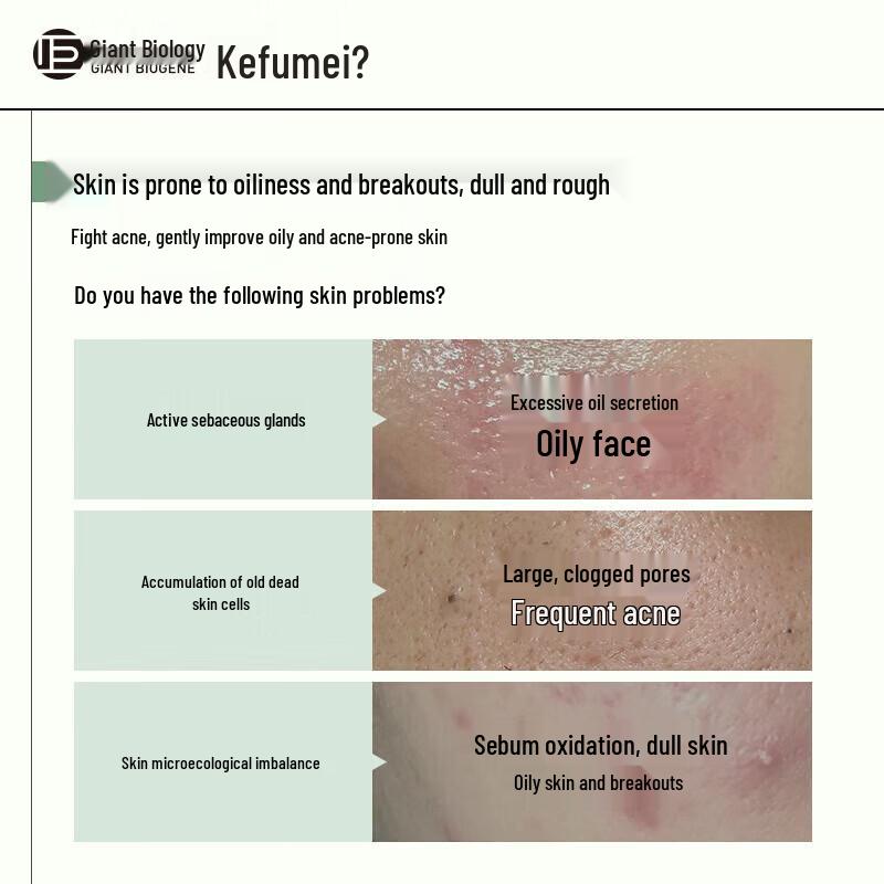 Kefumei Rare Ginsenoside Acne & Oil Control Skincare Set