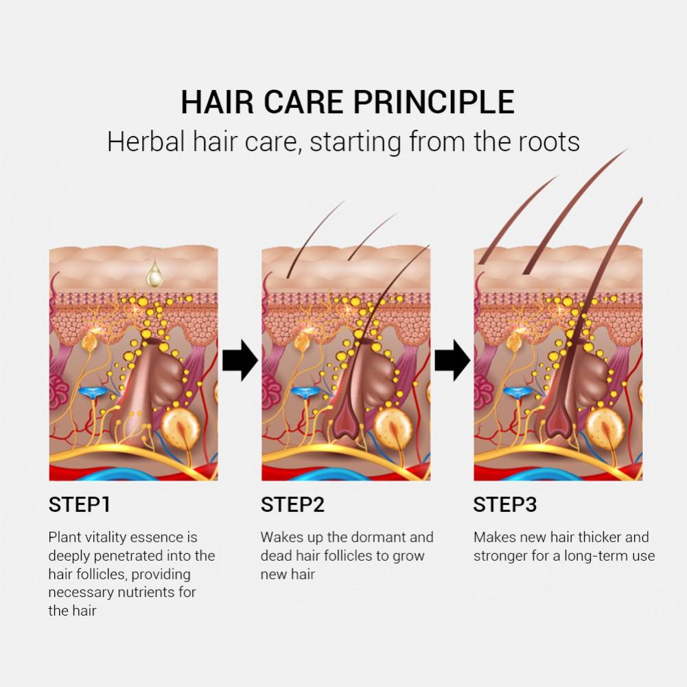 20ml Ginger Extract Hair Growth Essential Oils Fast Powerful Hair Care Anti-Drying Nourishing