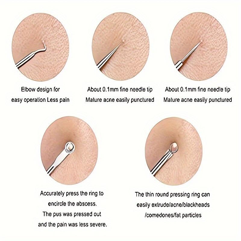 Acne Needle Set Blackhead Removal Tool Acne Extractor Acne Removal Set, Acne Nose Face Tool with Box for Blemishes