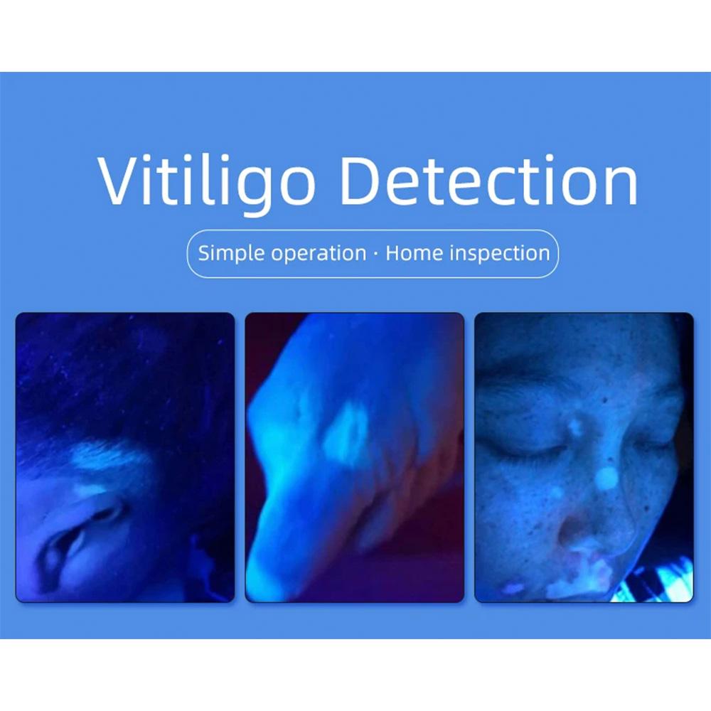 Wood's Lamp Ultraviolet UV Skin Analysis Tool Personal Beauty Care Skin Care Magnifying Analyzer for Daily Beauty Use