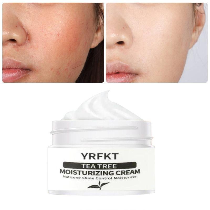 Tea Tree Moisturizing Serum Cream Anti-Acne Shrink Pores Face Cream Oil Control Hydrate Smooth Repair Skin Care